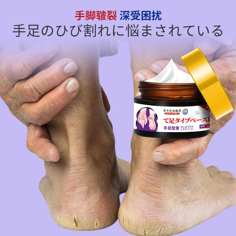 Heel Treatment Cream for Cracked Hands and Feet Finger Cleft Bleeding Keratosis Repair Cream with Dry Peeling Body Application