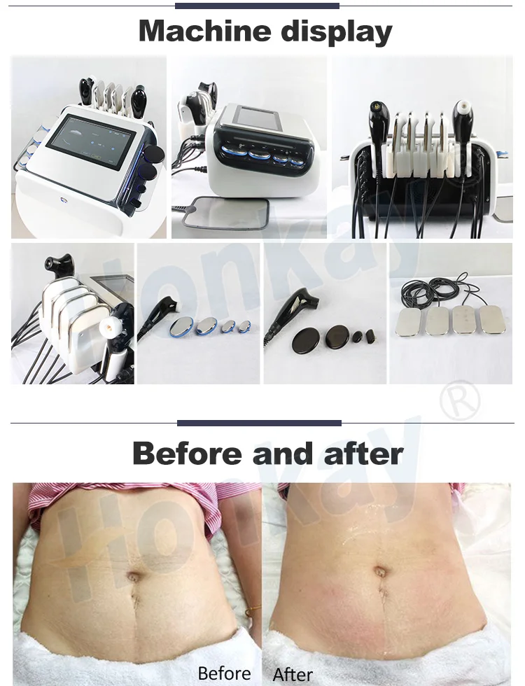 Ce Physio Tecar 3 in 1 Oem Back Pain Relief Smart Tecar Monopolar Radio Frequency Cet Ret Rf 448khz Tecar Therapy Physiotherapy