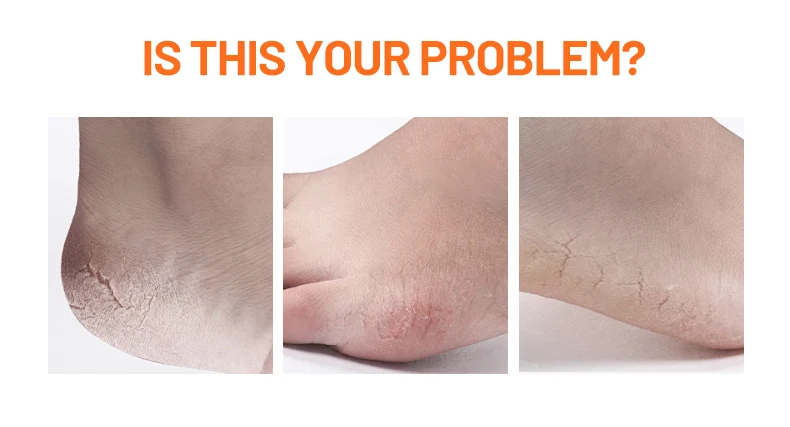 Factory Papaya Foot Peeling Mask Sock Niacinamide Extract Foot Crack Skin Care Moisture Foot Exfoliating Peel Mask