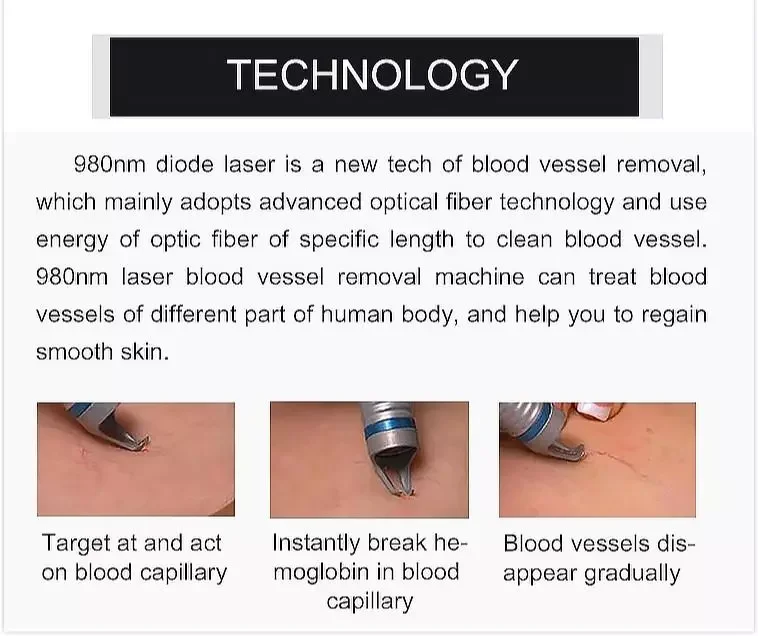 Hight power 6 In 1 980Nm Diode Laser vascular removal gentle soft tissue physiotherapy 60W spider vein removal