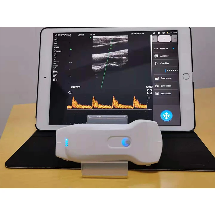 YUVNICE Veterinary Ultrasound Scanner Android Portable Ultrasound Machine Viatom 128 Elements Wireless Ultrasound Probe 3 in 1