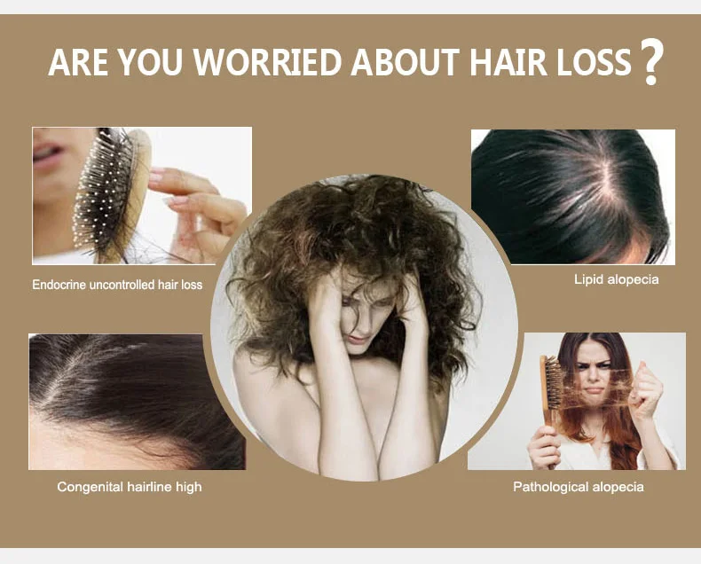 Natural Pure Hair Growth Essential Oil Ginger Hair Growth Oil 30ml