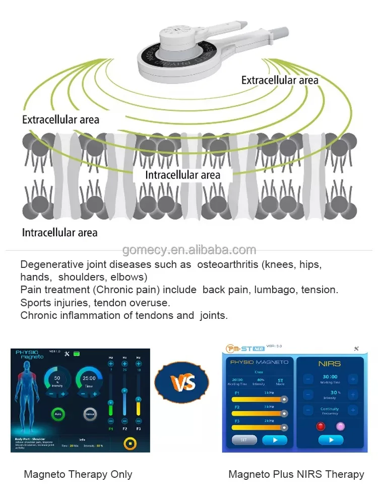 gomecy-physio-magneto-plus-nirs-therapy-pm-st-neo-transduction-physio-magneto-extracorporeal-machine