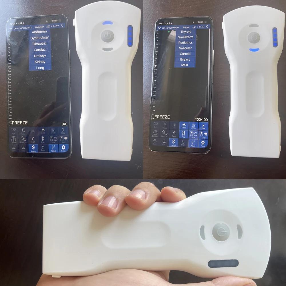 Suresult Professional Medical Devices: Wireless USG Ultrasound Probe for IPhone & IPad