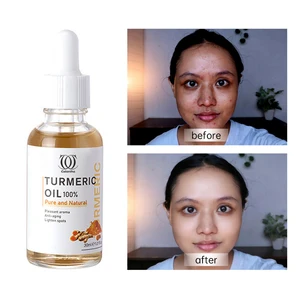 Hot Selling Skin Care Glow Lightening Whitening Vitamin C Turmeric Hydration Anti-Aging Dark Spot Corrector 30ml Serum Face