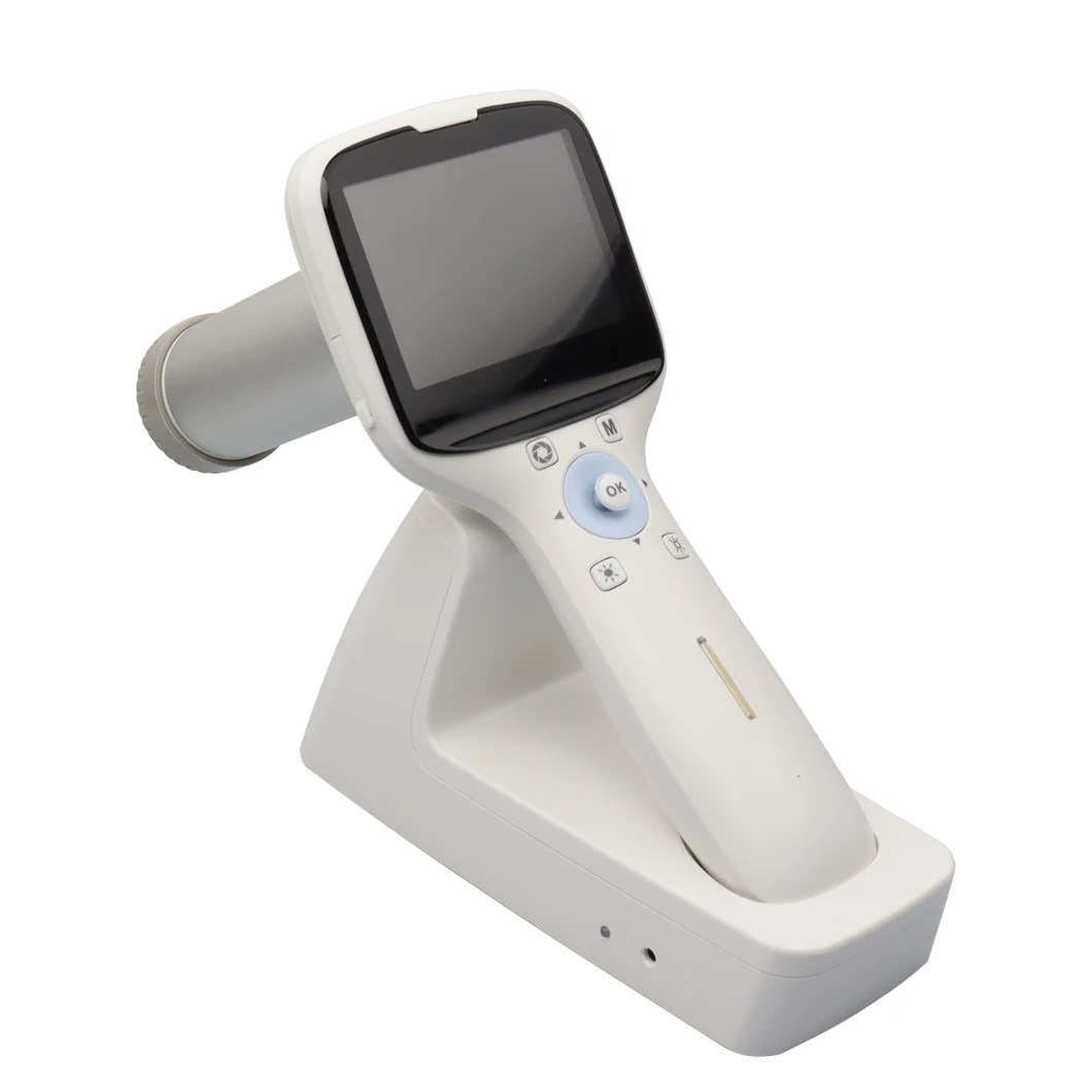 Big Discount Ophthalmic Diagnosis Portable Handheld Non-mydriatic Digital Fundus Retinal Camera