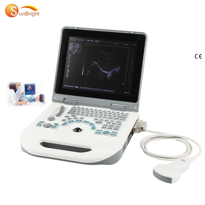 SUN-806G Hospital Mobile Digital Laptop Ultrasonic Diagnostic Equipment to Human Ultrasound Scanner-121022