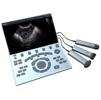 SonoAir30 ultrasound machine SonoAir Vet70 Portable ultrasound  system 14.1 inch LCD display SonoAir V60 vet Ultrasound