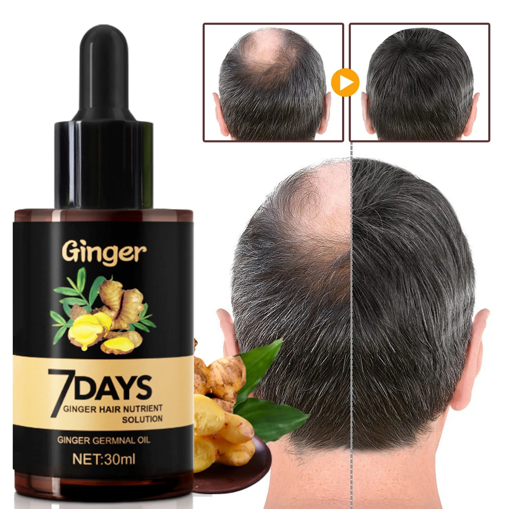 Best Selling Leenmay Organic Hair Care Treatment Private Label Hair Growth  7 Days Ginger Hair Oil - Buy Hair Regrowth,Hair Loss Area,Anti Hair Loss  Oil Product on 