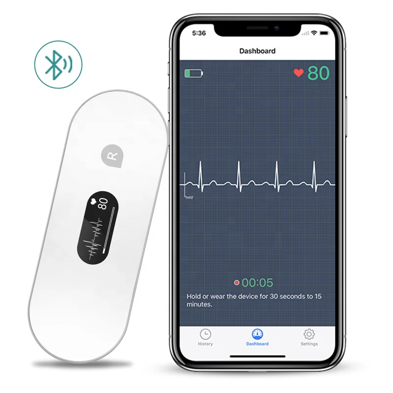 Portable ECG Monitor