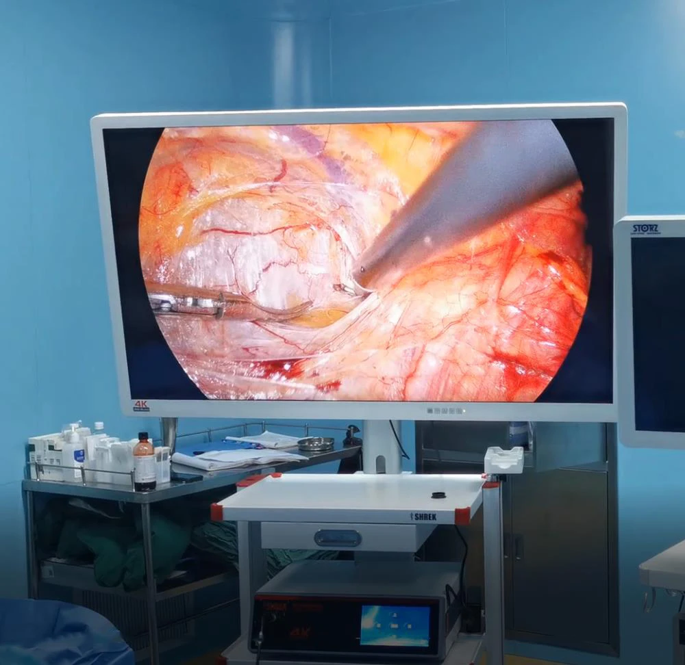 2023限定セール】 硬直内視鏡手術用医療カメラ4k内視鏡 Buy Rigid Endoscopic Surgery,Medical Camera  4k Product