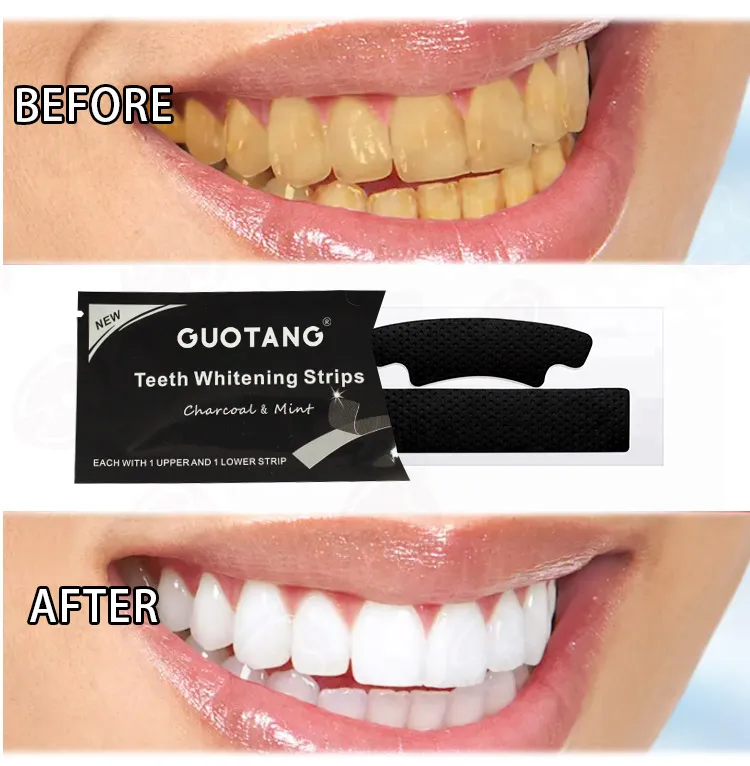 Logo Advanced Charcoal Dissolving Effective Best Dental Tooth Teeth