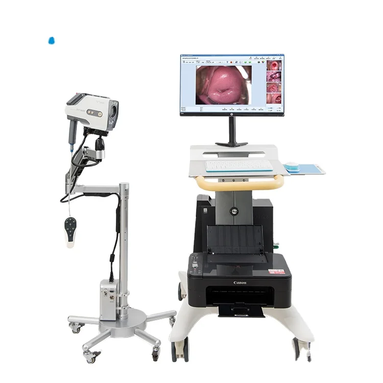 High Resolution Colposcope Video Camera Colposcopy Exam System Digital Colposcope AKX  YKD-3001