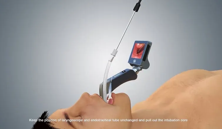 Reusable Video Laryngoscope for Children and Adult Surgical Intubation with Medical Endoscope Camera