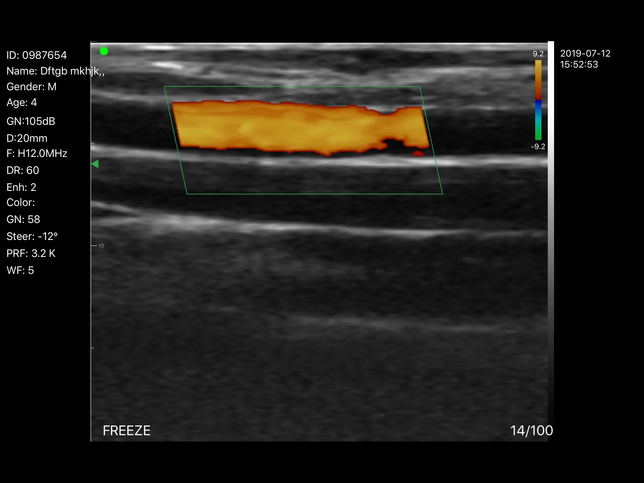 Factory Price Cardiac Sector Phased Array Probe Ultrasonic Ultrasound Linear Probe on Sale details