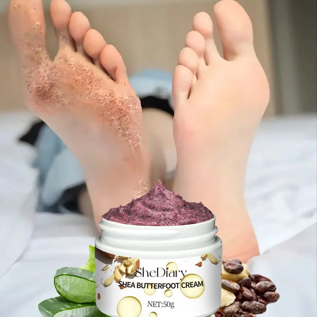 SheDiary-exfoliante para pies, exfoliación, eliminación de piel muerta, exfoliación, crema hidratante para el cuidado de los pies, crema reparadora para talones agrietados