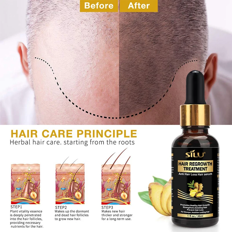 Custom 7 Days Fast Hair Growth Oil Treatment Ginger Hair Regrowth Serum of Hair Loss