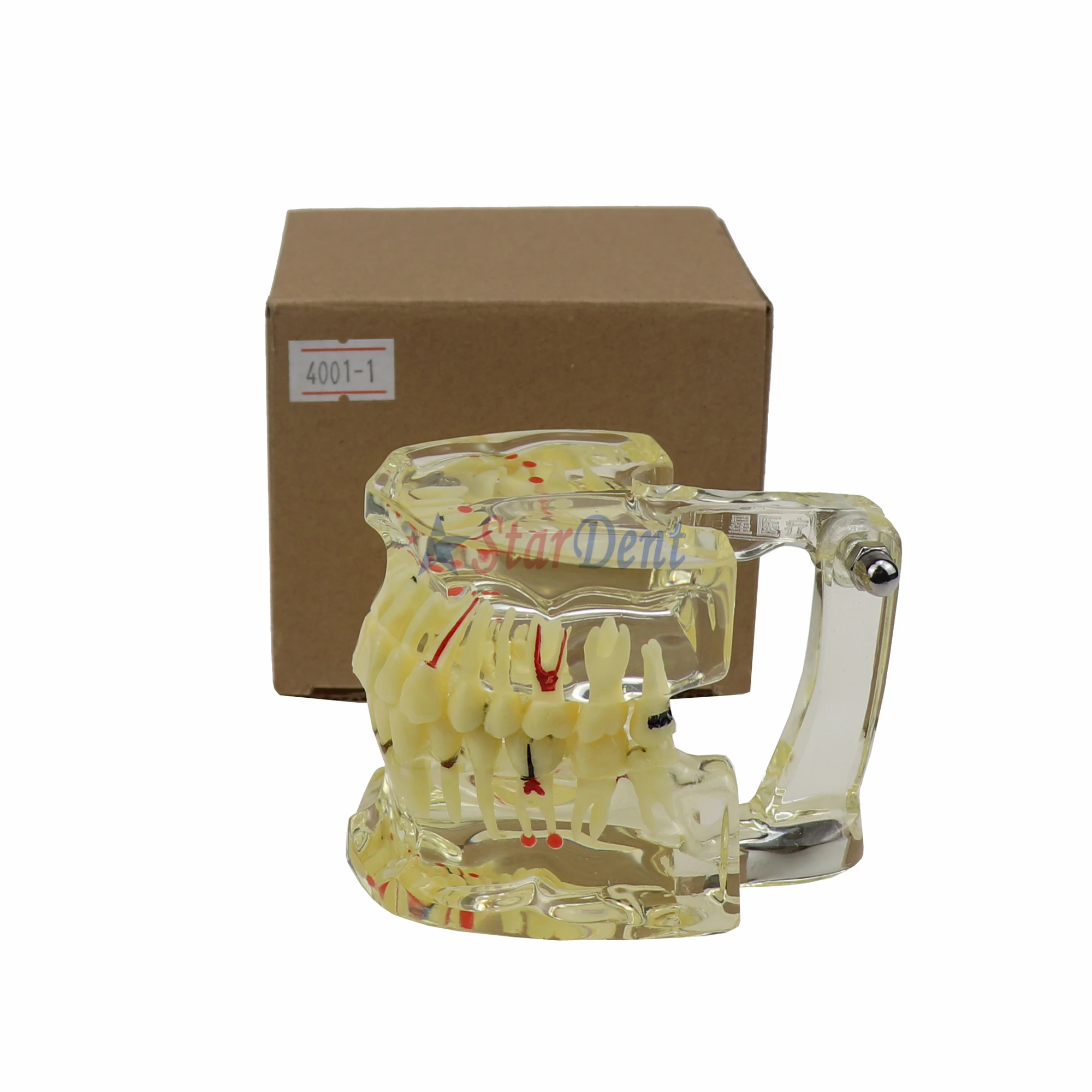 Apparecchio Trasparente (tipo SureSmile): Cos'è E Quando Usarlo - Foto 4