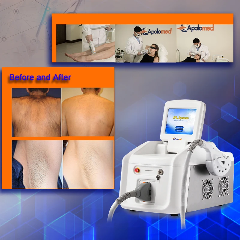 Opt Elight Magneto Ipl Permanent Electrolysis Hair Removal Machine ...