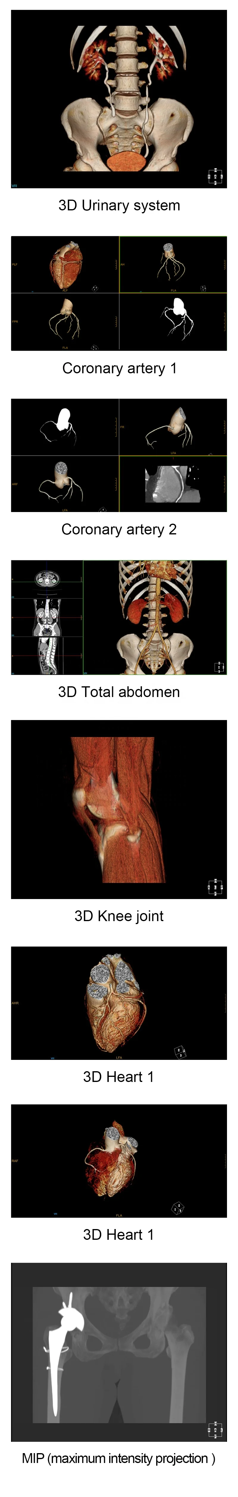 YSCT-128X High Performance 128 Slice CT Scan Machine Medical X-ray Computed Tomography Scanner System Coronary Artery Scanning