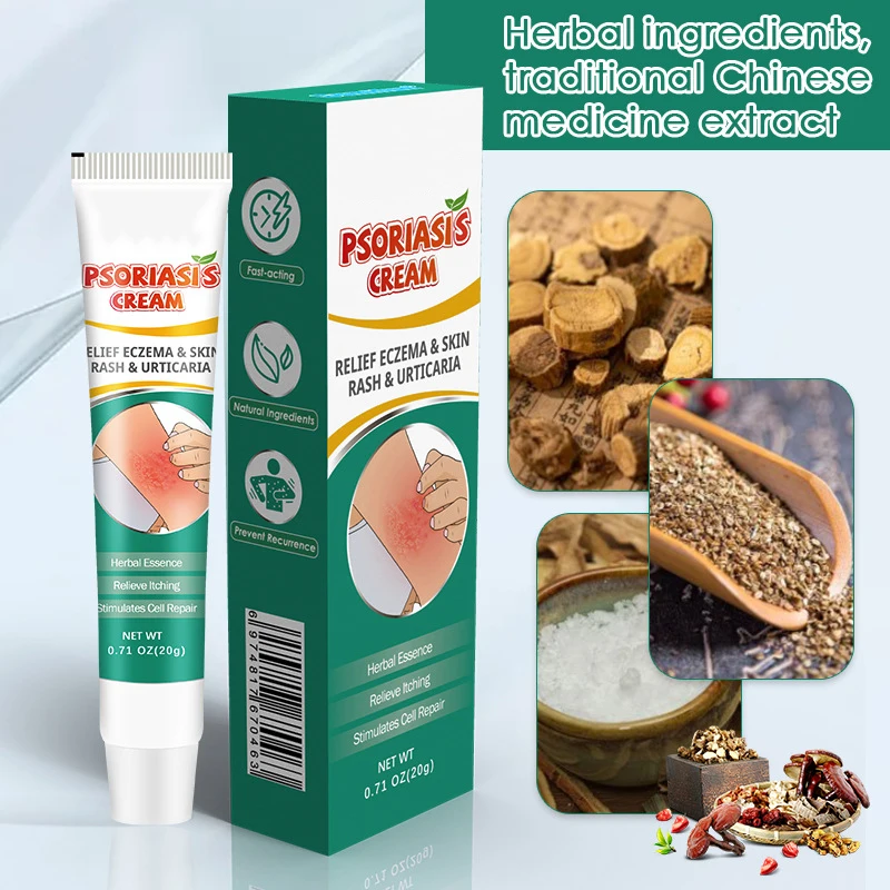 quick effective pure natural chinese herbal dermatitis pruritus psoriasis treatment cream ointment for skin problem