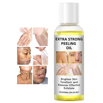 Extra strong bleaching oil African dard skin dark knees knuckles removal skin whitening yellow orange peeling oil