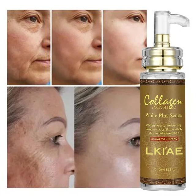 best hyperpigmentation serum arbutin glutathione Numbuzin No.5+ Vitamin Concentrated Review DermApproved Not anymore Glutathione for Hyperpigmentation: Effective Solutions