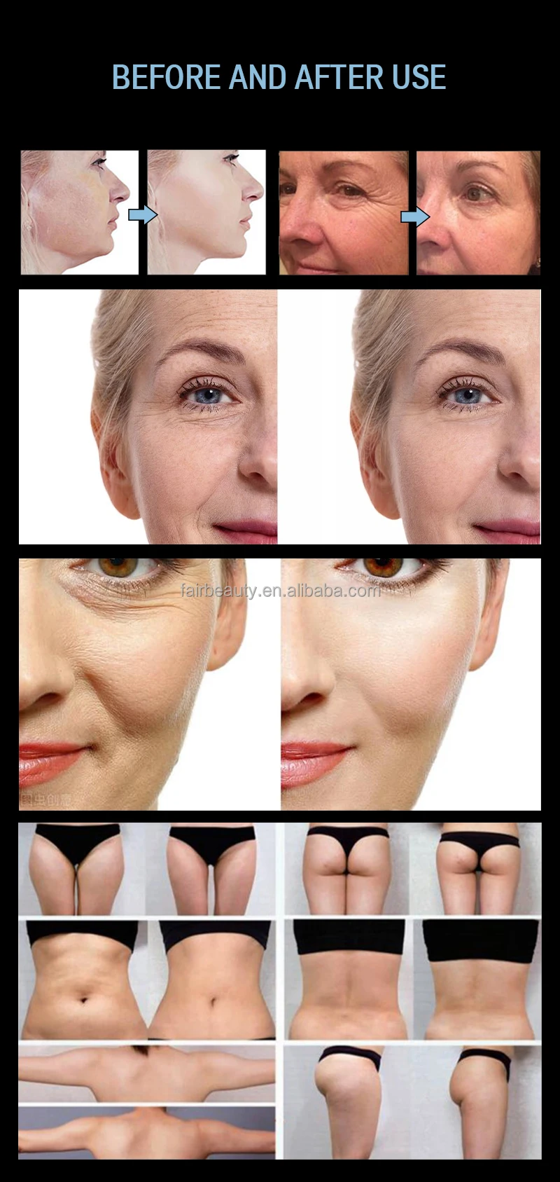 MedSpa Professional Setup Aurora AR Series