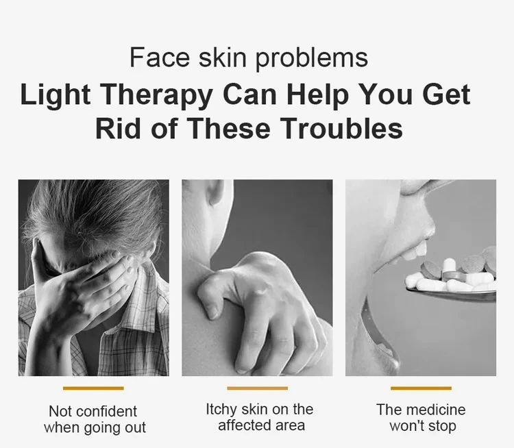 Uvb Lamp Uv Lamp Phototherapy Light Therapy Psoriasis 311nm Uvb Light Therapy Vitiligo Cream Treatment