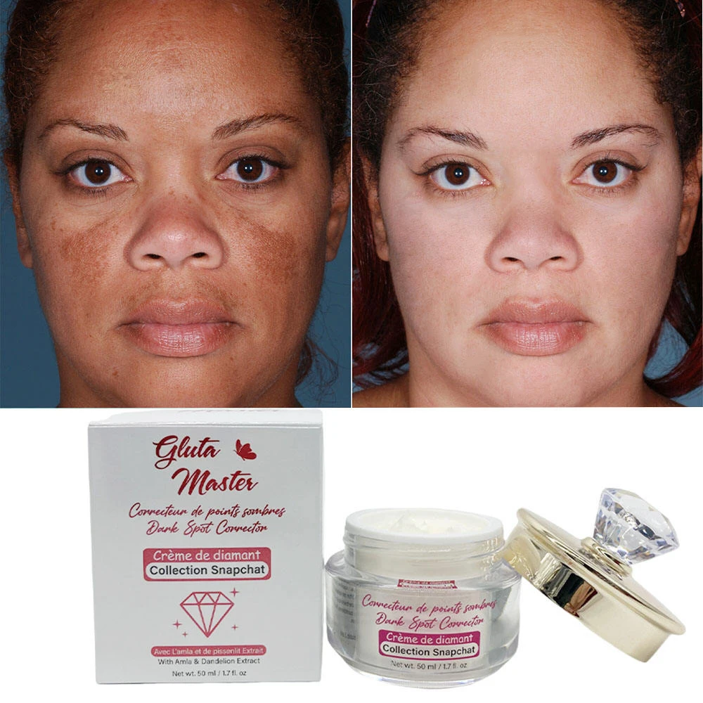 glutathione on black skin Miduty