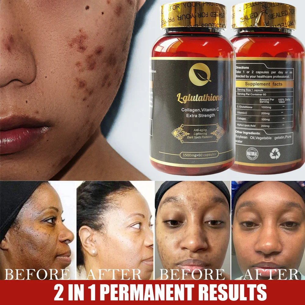 bhk glutathione review Glutathione: a powerful antioxidant for a healthy skin main image 1