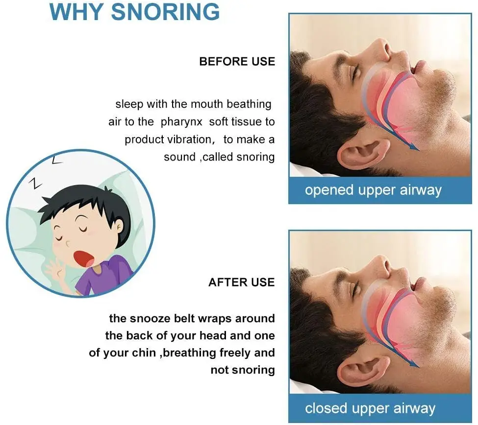 Triangular Sleeping Chin Strap Mouth Guard Snore Headband Stop Snoring ...