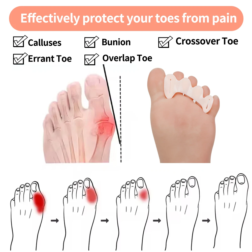 Free Sample Customized Breathable Silicon Gel Toe Separators and Bunion Spacers Finger Separator