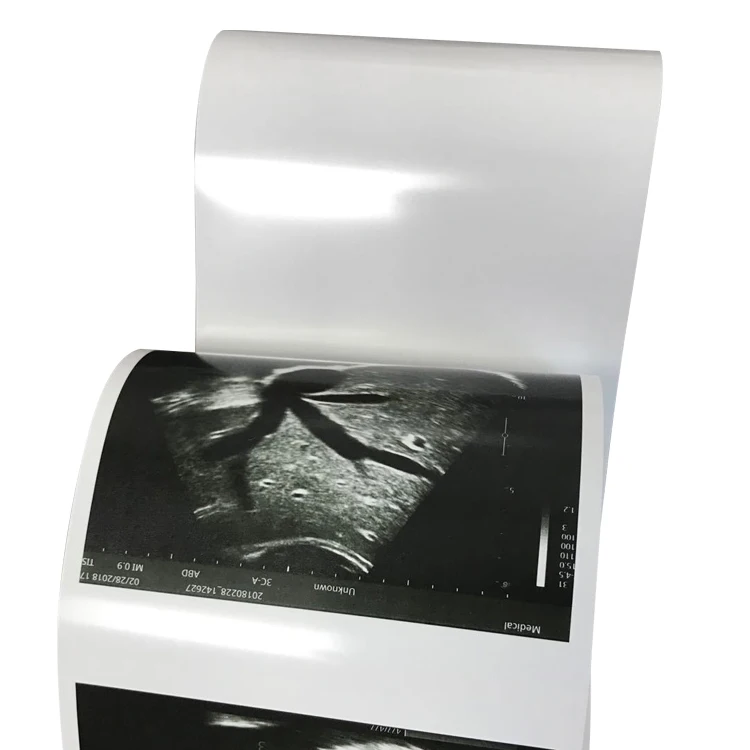 Original High Glossy Type V 110x18m Video Print UPP-110HG Ultrasound Thermal Paper for Sony Printer