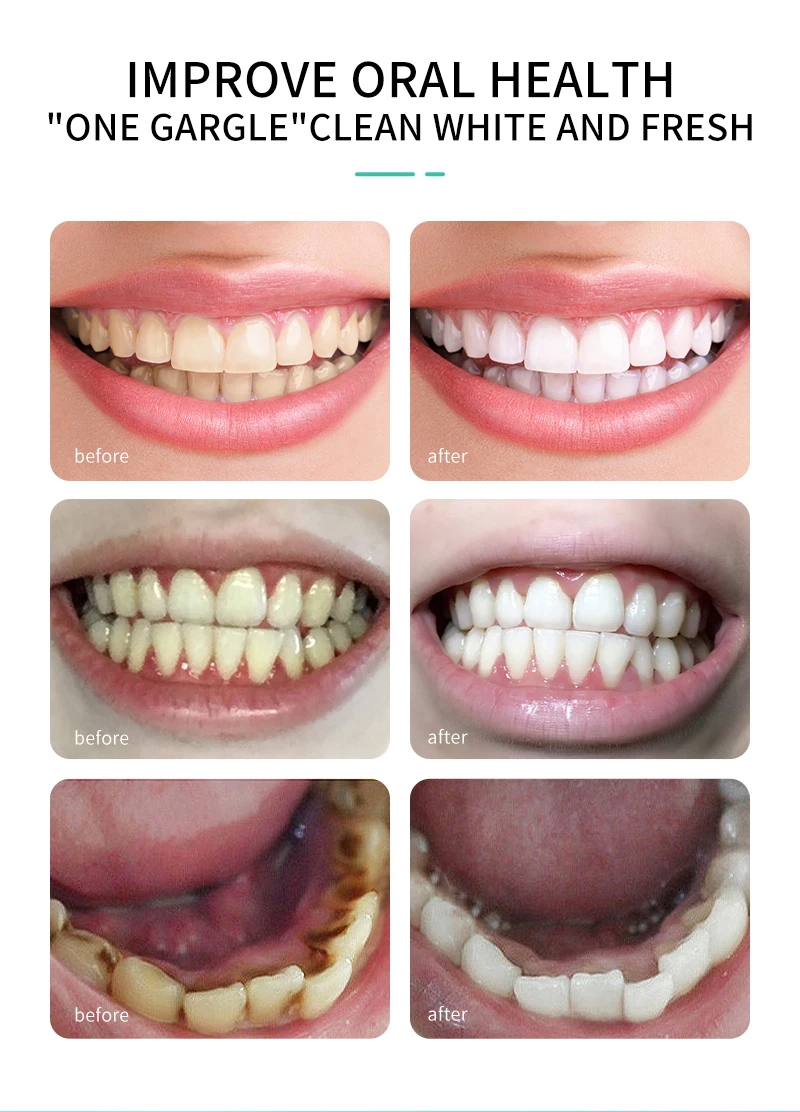 Coconut Oil Pulling Natural Essential Oil And Vitamin E Alcohol Free