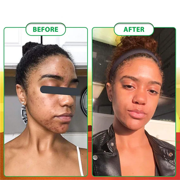 african black soap (11)