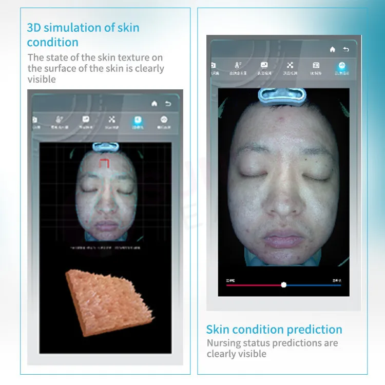 Moji AI profession intelligent imager face skin texting scanner 3d facial skin camera color analyzer machine facial