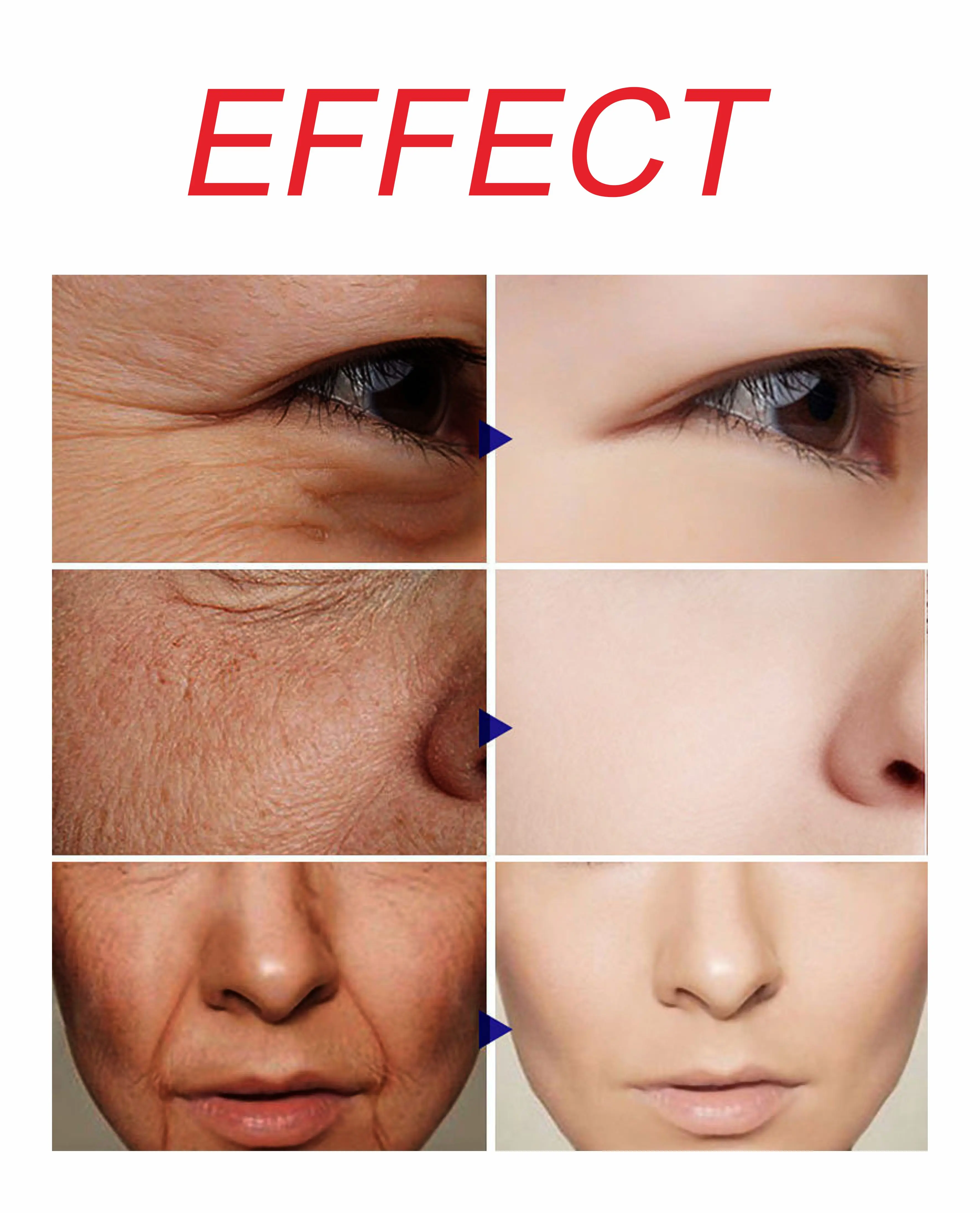 Private Label Cosmetics Anti Aging Whitening Vegan Quantity Egg Yolk OEM  Wholesale Half Cast Skin Care Serum