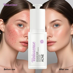 Christmas Kit Wholesale Custom Removes Dark Spots Powerful Acne Skin Toner Fights Wrinkles Protects Skin Anti-Aging Toner