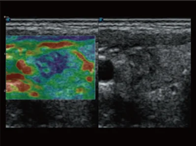 Sonoscape P20 Mobile 3D/4D Real-time Color Panoramic Doppler Trolley Ultrasound Machine manufacture