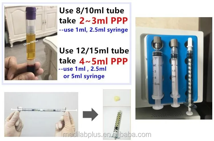 2025 Laboratory Centrifuge Beauty Products AP05 Heating 5ml PPP Bio Filler Plasma Gel Maker Machine