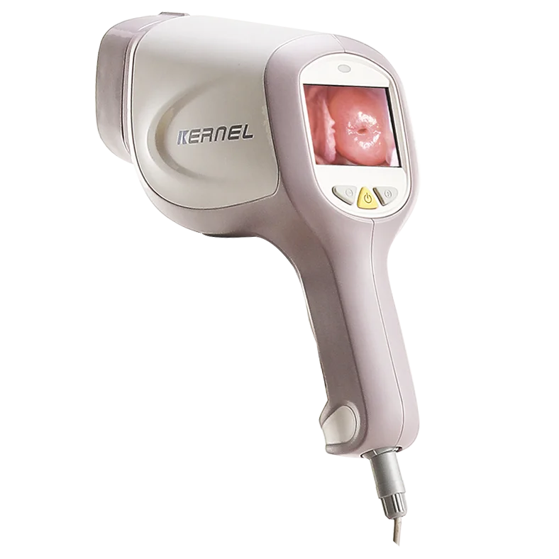 Kernel KN2200I HD CCD Camera Digital Video Kernel Optic Colposcope for Gynecology Colposcopy with Software