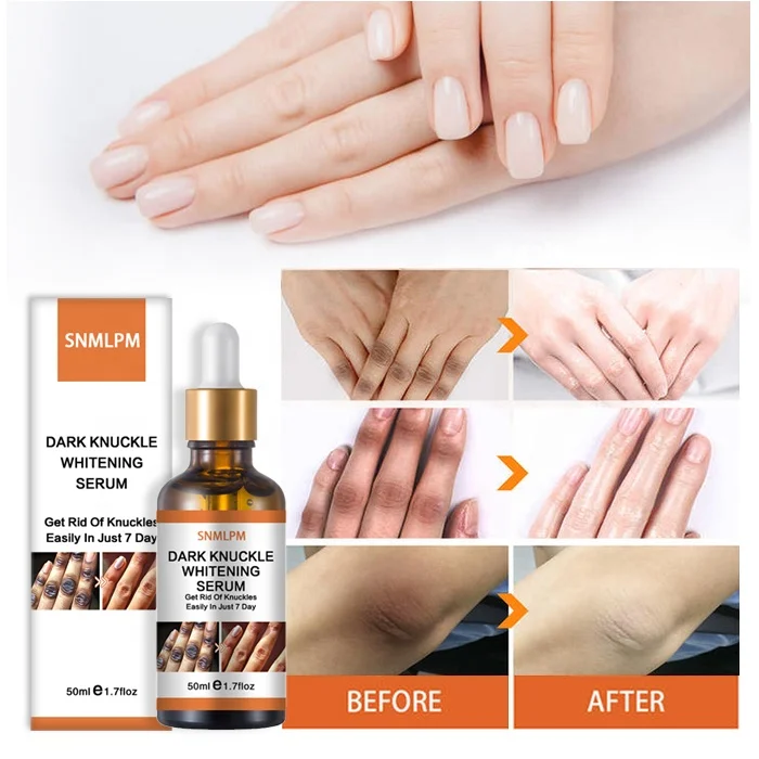 SNMLPM Whitening Dark Knuckle Serum Intense Knuckle Removal Whitening Removing Dark Knuckles Serum for Elbow and Knee