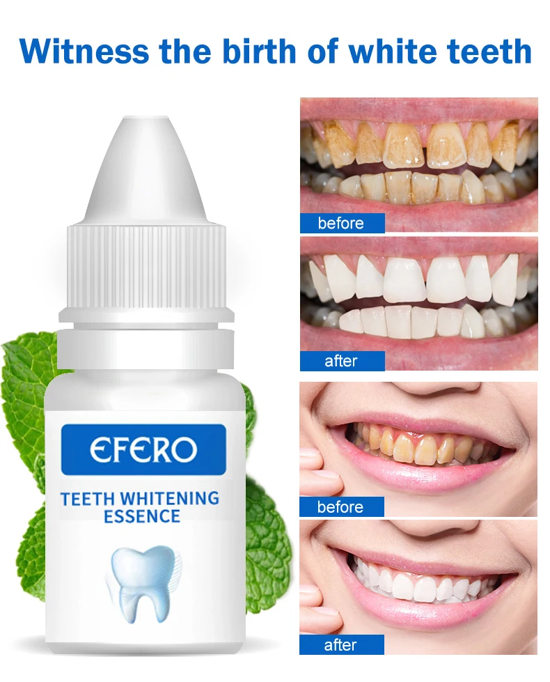 Essence Teeth Whitening Efero No Sensitive Whitening Teeth Essence Low