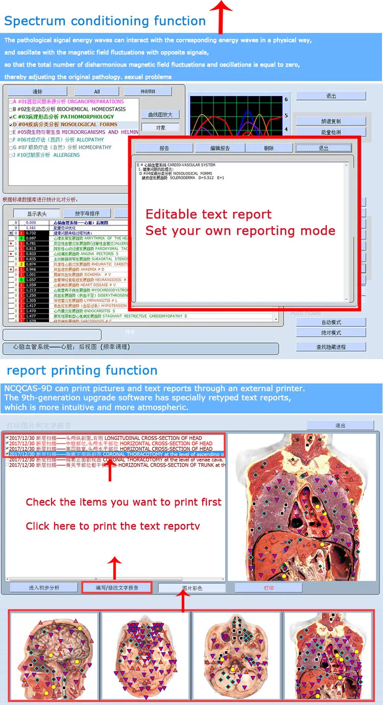 Portable USB DIZI A-200A 9D Detector NLSERA Health Management System 18D NLS Body Sub-health Organ Cell Cardiovascular Analyzer
