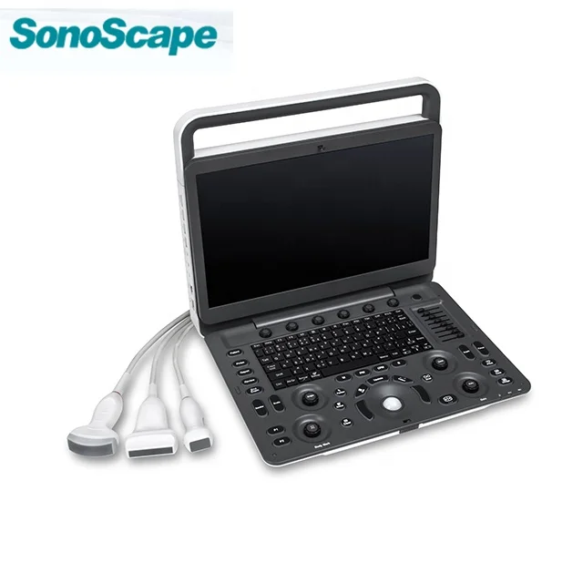 SonoScape E3 Cardiac Vascular Digital Color Doppler Portable Ultrasound Machine