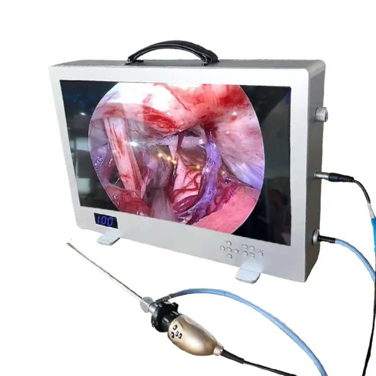 All in one hd 1080p 24inch endoscopy camera cover  laptop style endoscope camera endoscopy ccd camera