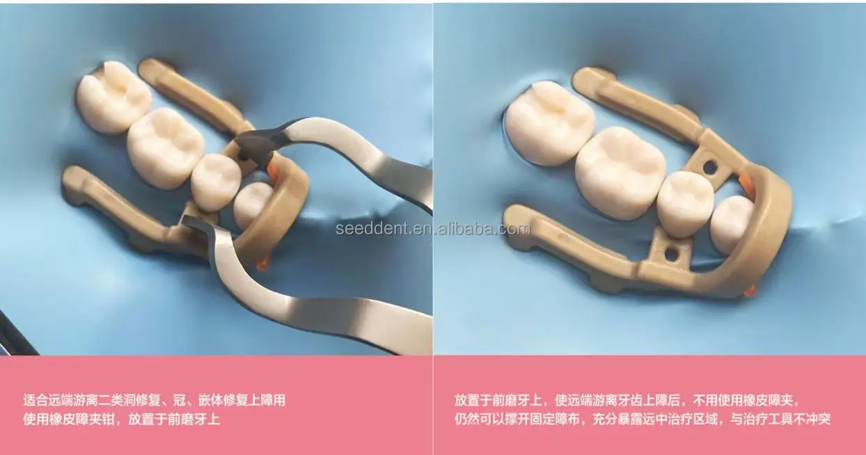 Dental Distalextension Dental Dam Clamp Rubber Dam Clamp Buy