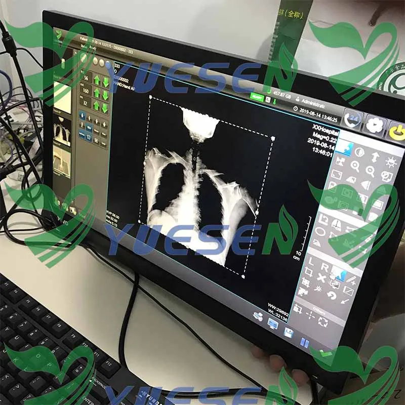 YSX050-C 5.0kW 100mA ветеринара рентгеновское оборудование мобильный и портативный кронштейн цифровой ветеринарный рентгеновский аппарат