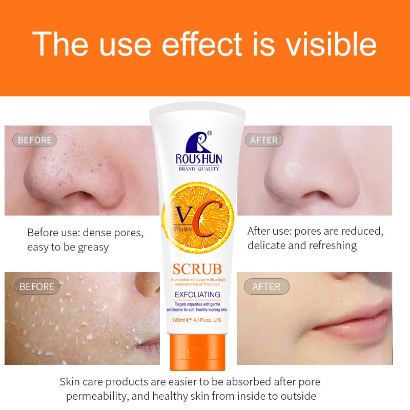 ROUSHUN  VC Scrub 120ml  a Complete Skin Care With a High Concentration of Vitamin c Good Quality